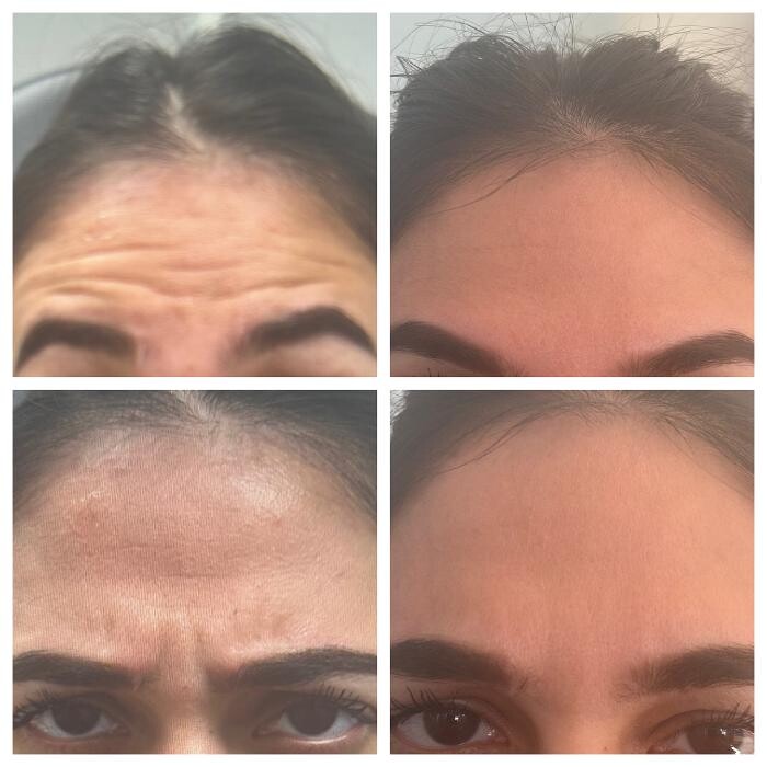 Images dermani MEDSPA Duluth