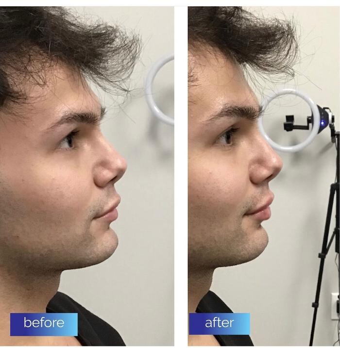 Images dermani MEDSPA Duluth