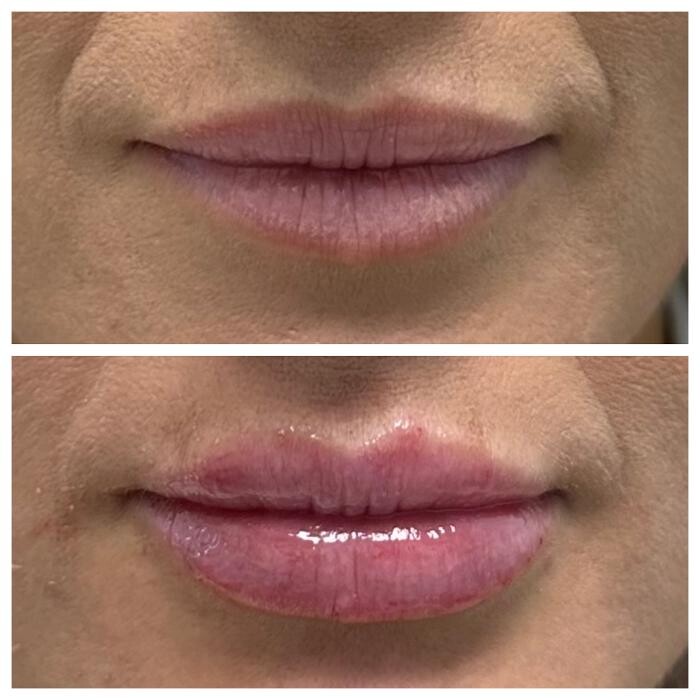 Images dermani MEDSPA Duluth