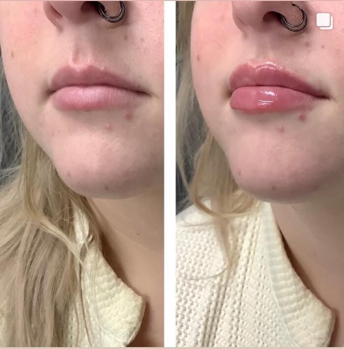 Images dermani MEDSPA Duluth