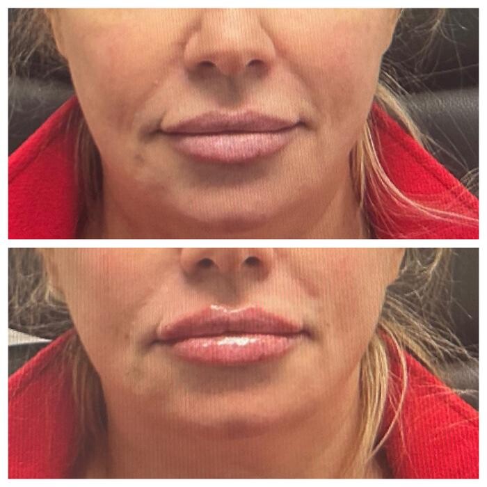 Images dermani MEDSPA Duluth