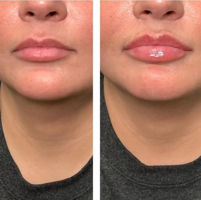 Images dermani MEDSPA Duluth