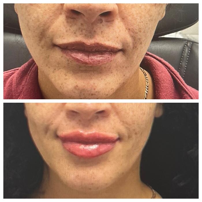 Images dermani MEDSPA Duluth