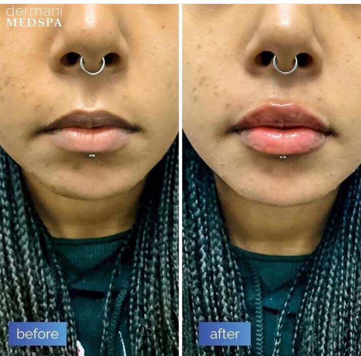 Images dermani MEDSPA Duluth