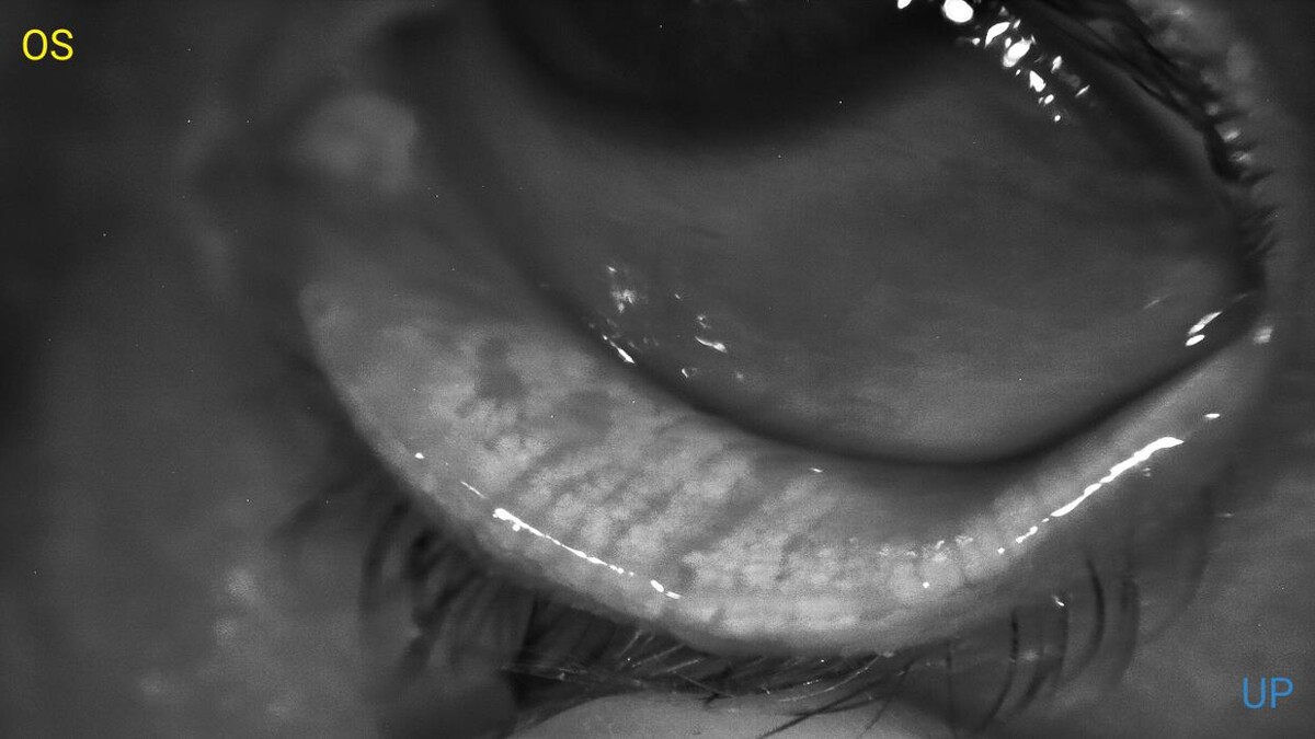Images OptiHealth Optometry