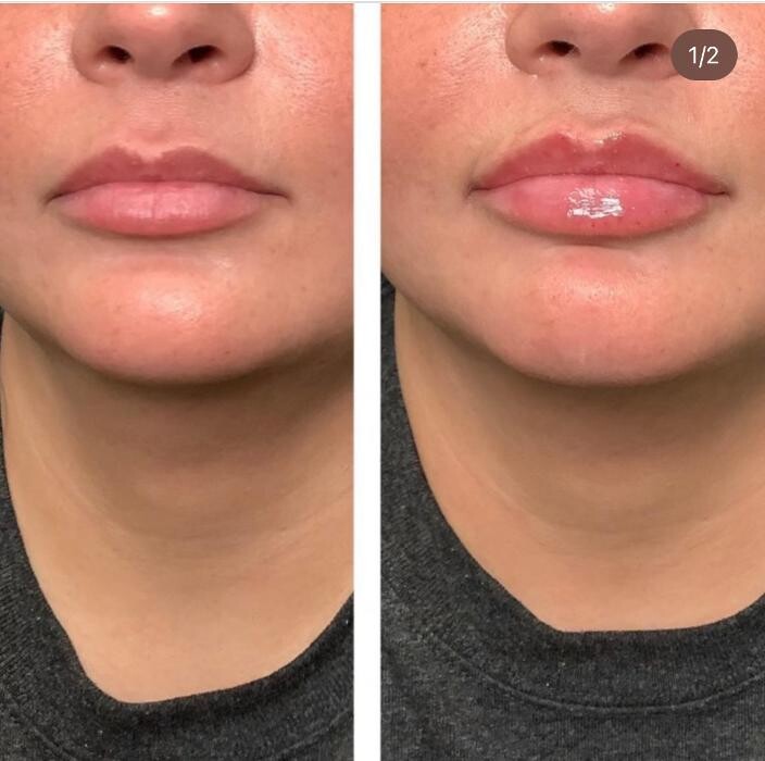 Images dermani MEDSPA East Cobb