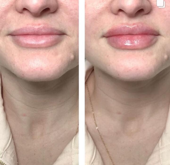 Images dermani MEDSPA East Cobb