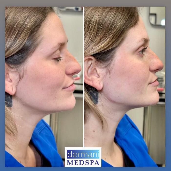 Images dermani MEDSPA East Cobb