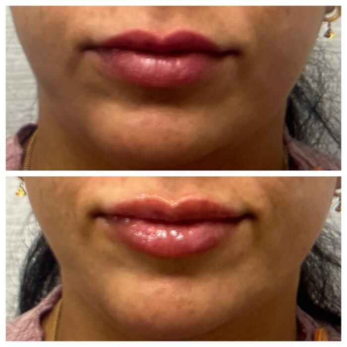 Images dermani MEDSPA East Cobb