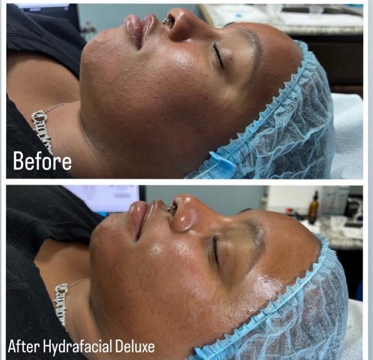 Images dermani MEDSPA East Cobb