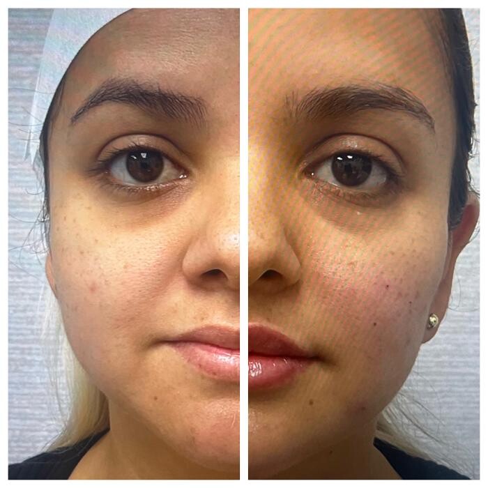 Images dermani MEDSPA East Cobb