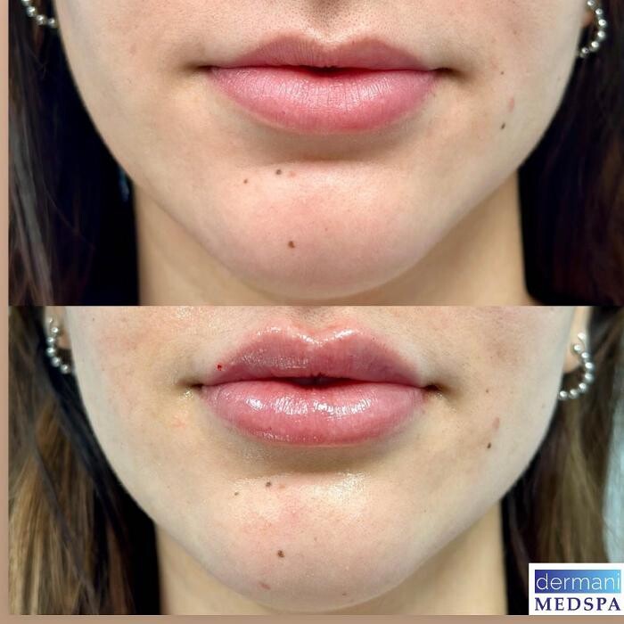 Images dermani MEDSPA East Cobb