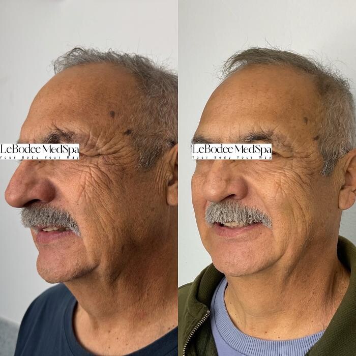 Images LeBodee MedSpa