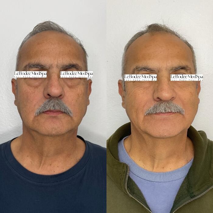 Images LeBodee MedSpa