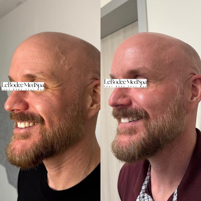 Images LeBodee MedSpa