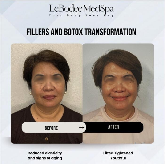 Images LeBodee MedSpa