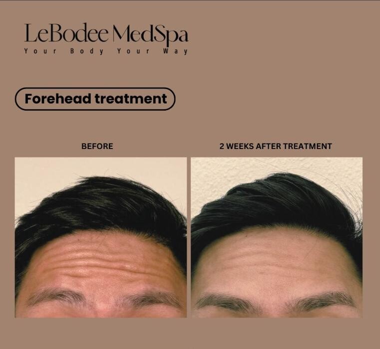 Images LeBodee MedSpa