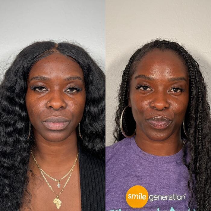 Images LeBodee MedSpa