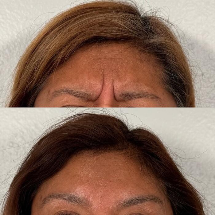 Images LeBodee MedSpa