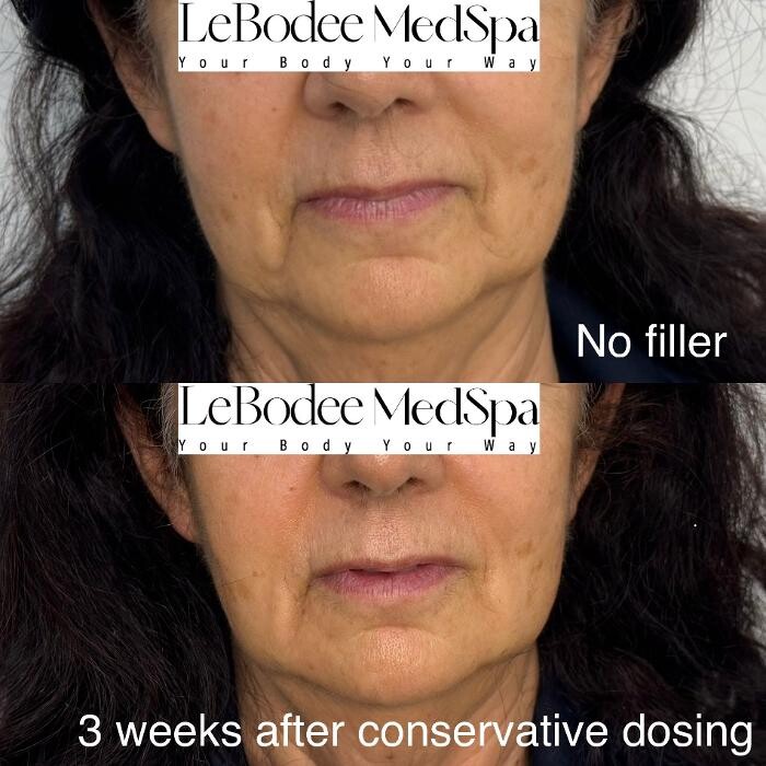 Images LeBodee MedSpa