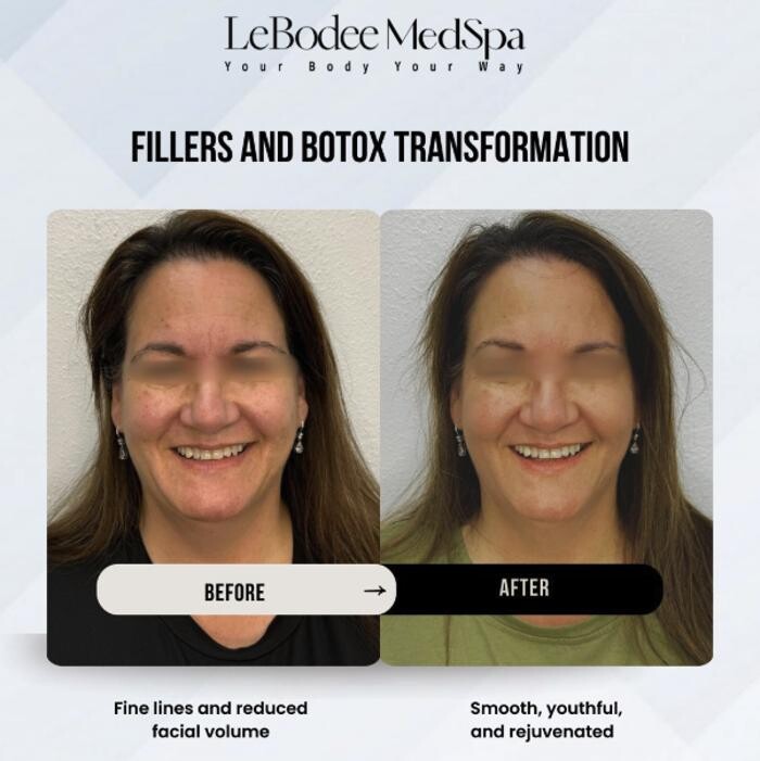 Images LeBodee MedSpa