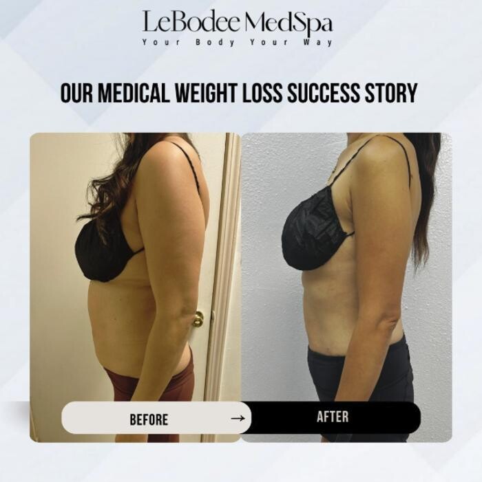 Images LeBodee MedSpa