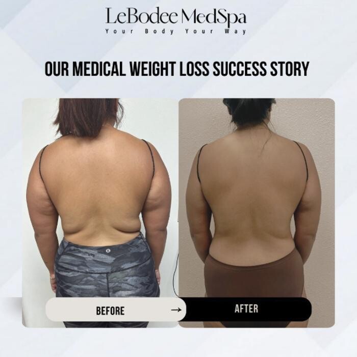 Images LeBodee MedSpa