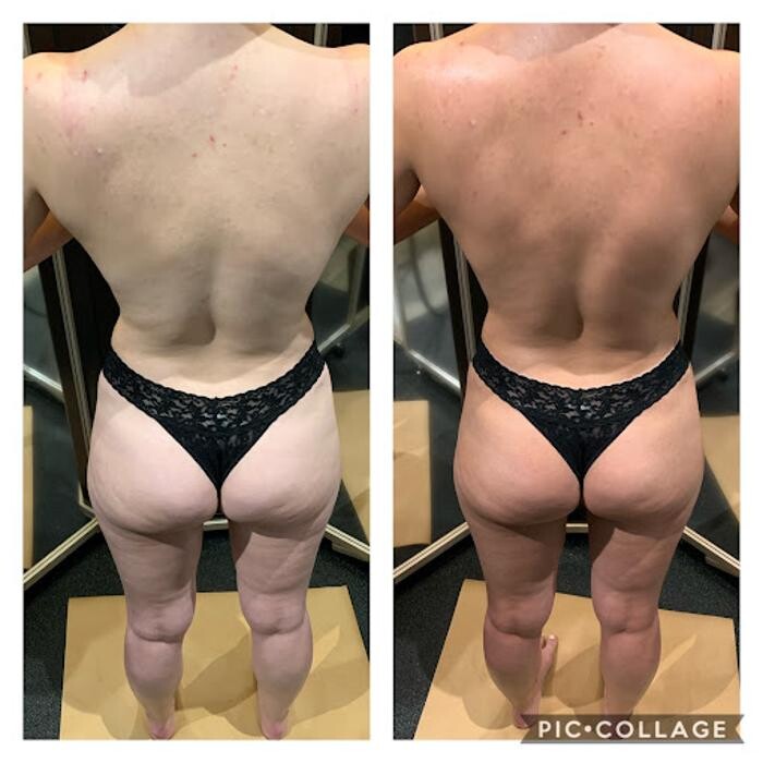Images Body Glow New york