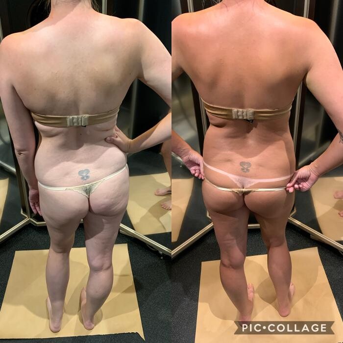 Images Body Glow New york