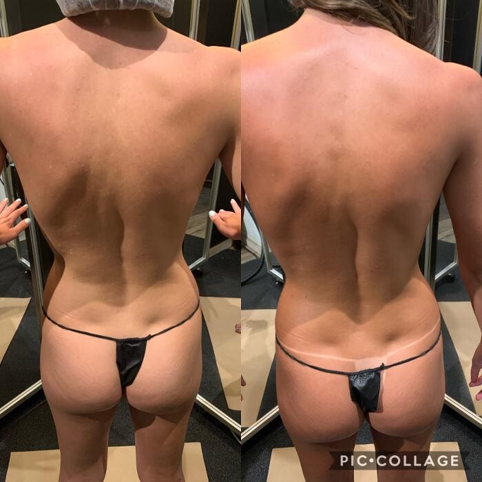 Images Body Glow New york