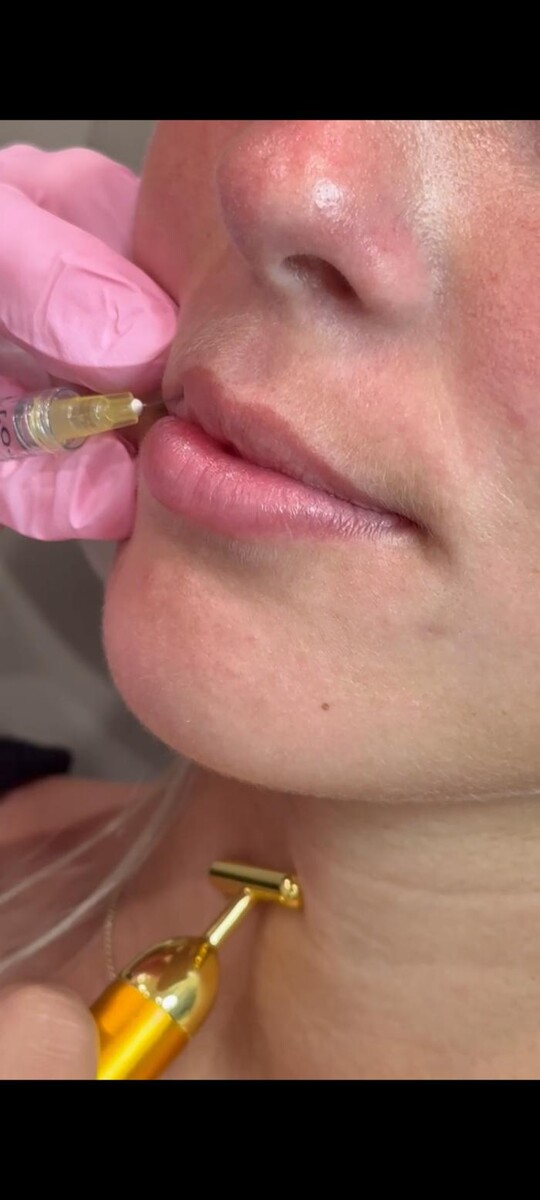 Images Glo MedSpa