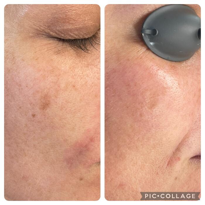 Images Bellina Ame Medspa