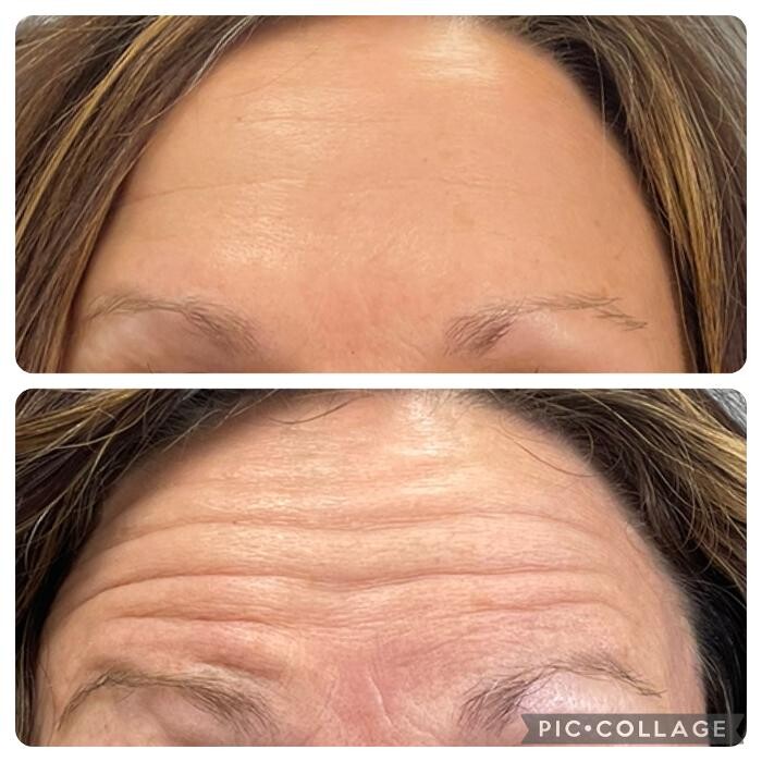 Images Bellina Ame Medspa