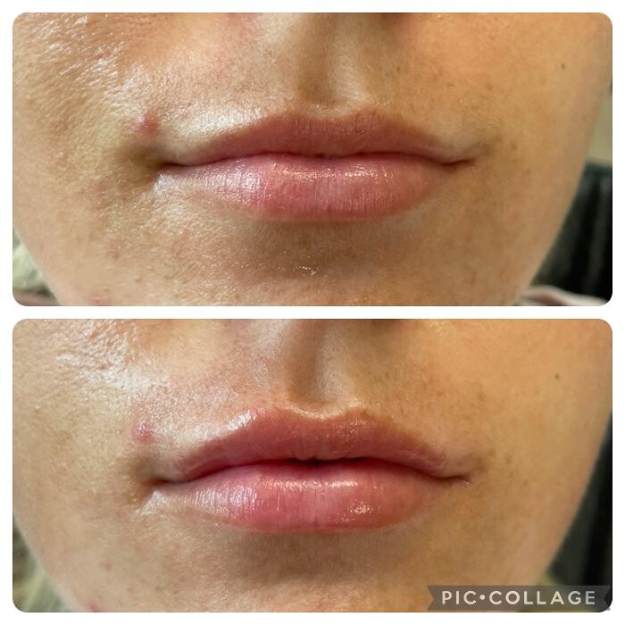 Images Bellina Ame Medspa