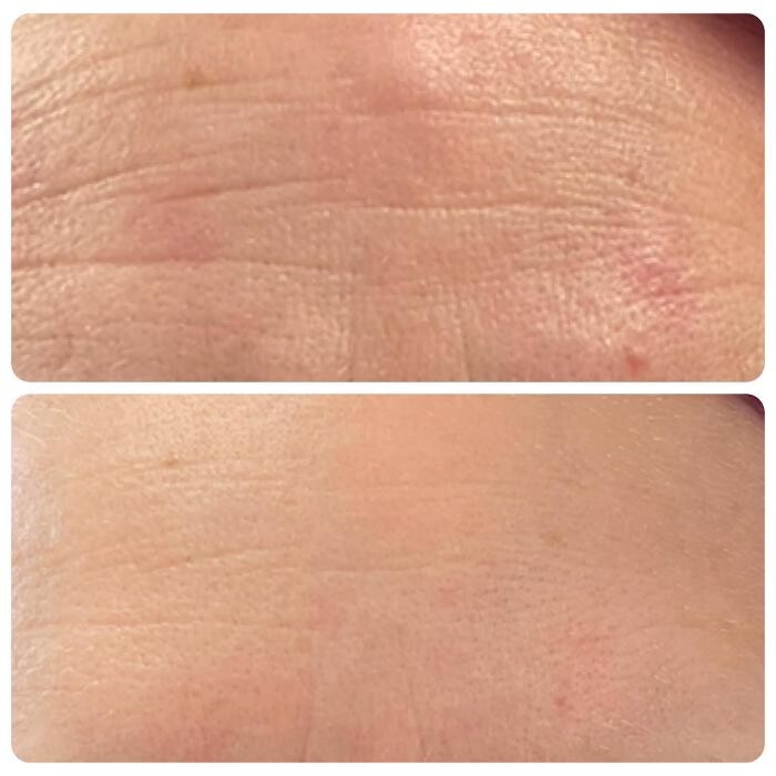 Images Bellina Ame Medspa
