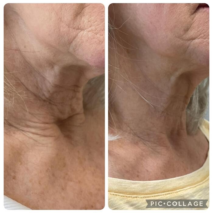 Images Bellina Ame Medspa
