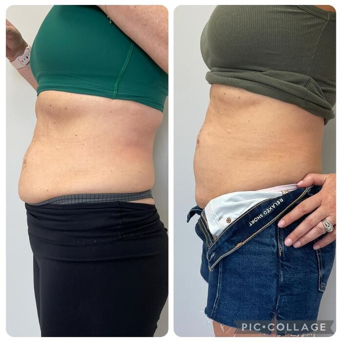 Images Bellina Ame Medspa