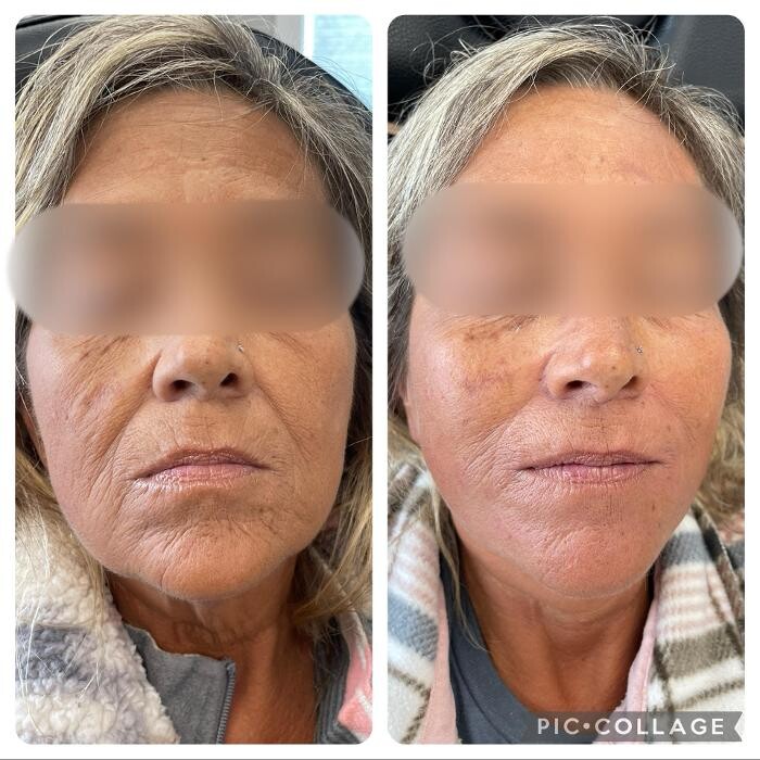 Images Bellina Ame Medspa