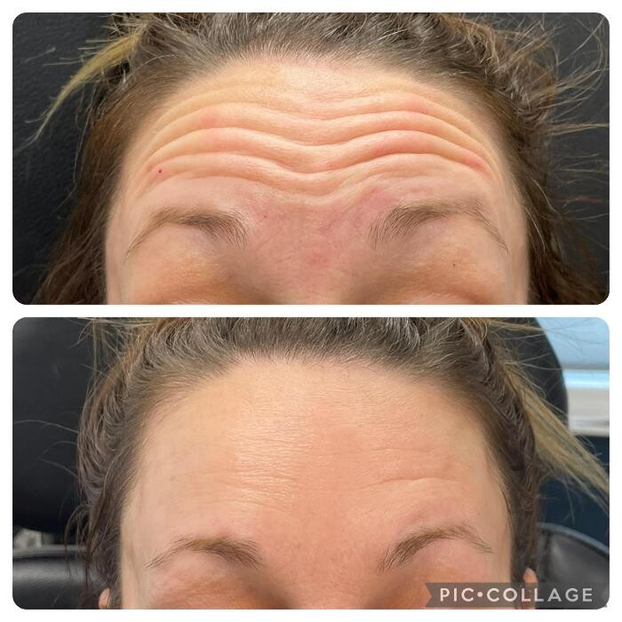 Images Bellina Ame Medspa