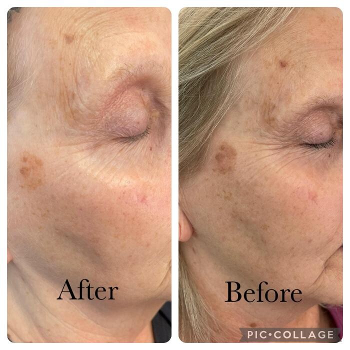 Images Bellina Ame Medspa