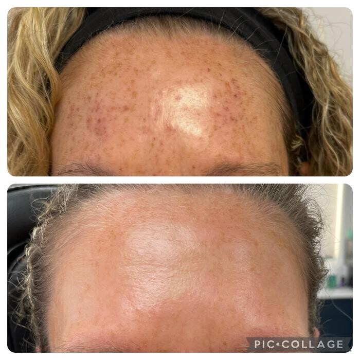 Images Bellina Ame Medspa