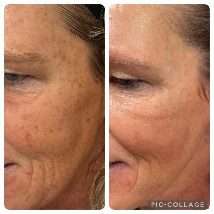 Images Bellina Ame Medspa