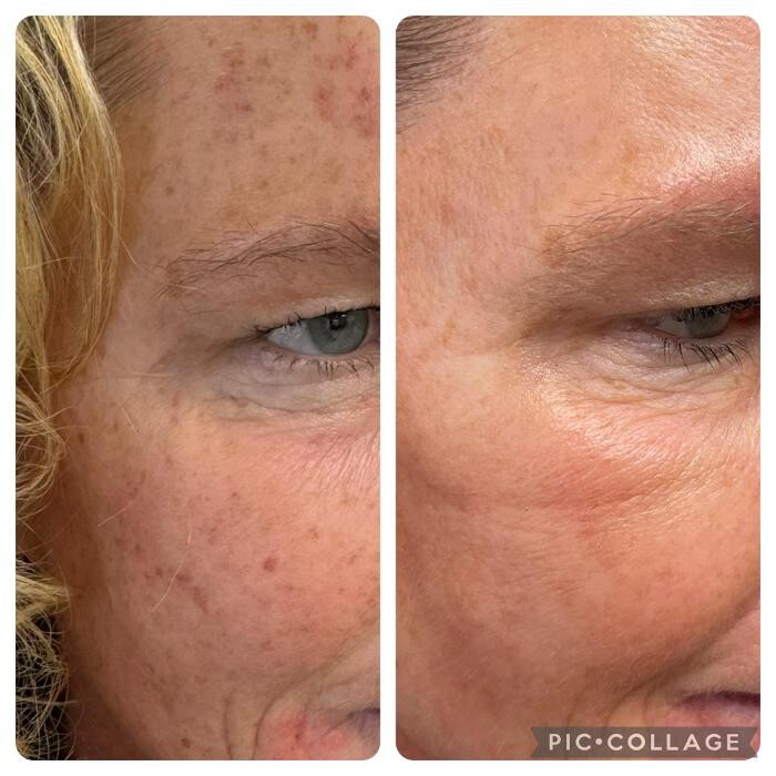 Images Bellina Ame Medspa