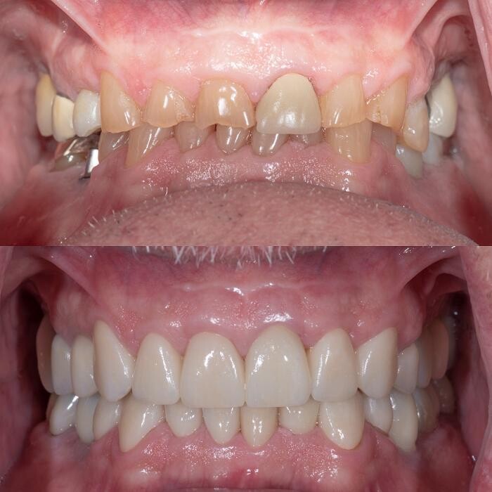 Images Mission Dental - Placentia