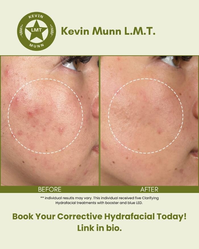 Images Kevin Munn LMT