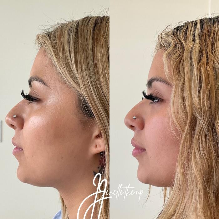 Images Sileo Medical