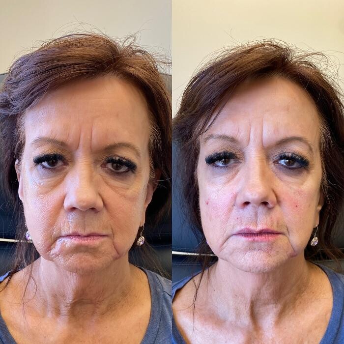 Images Sileo Medical
