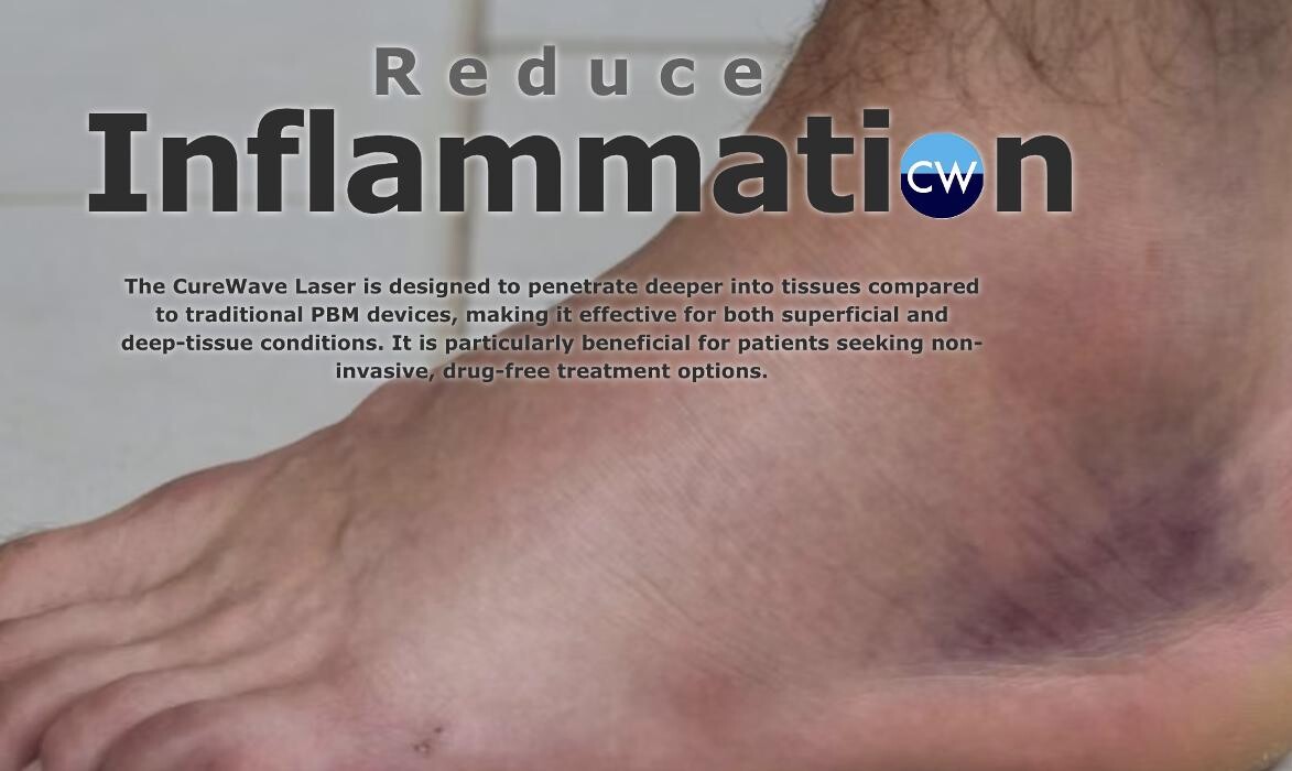 Images CureWave Lasers