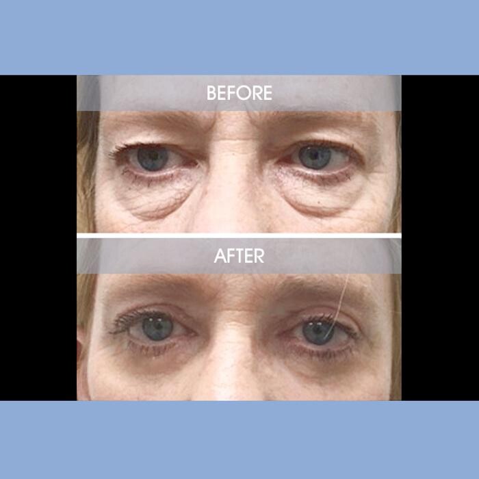 Images Darrick E. Antell M.D., F.A.C.S.