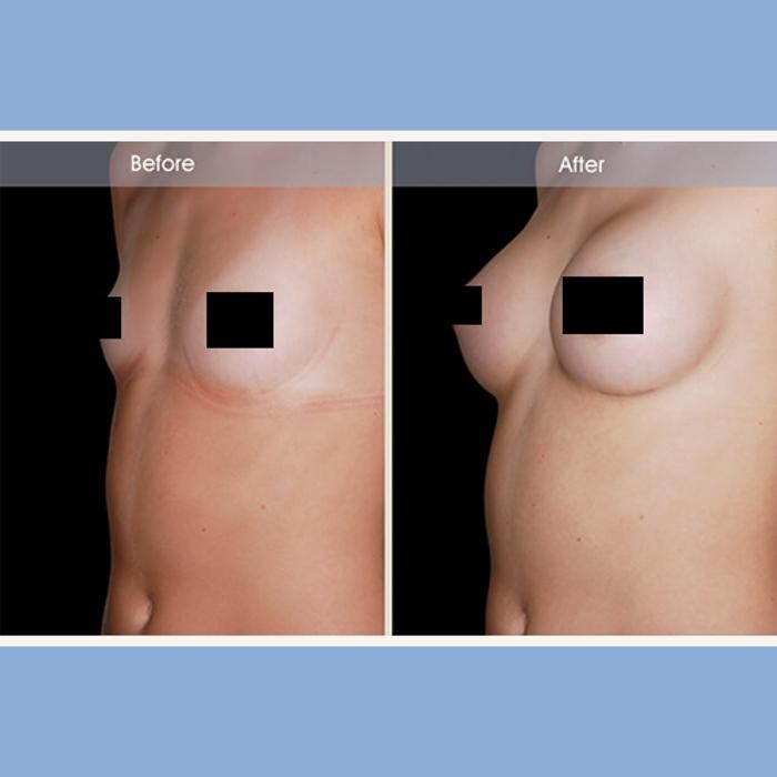 Images Darrick E. Antell M.D., F.A.C.S.